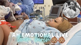 THE LIVE BIRTH OF OUR SECOND SET OF TWINS  Real Raw amp Emotional Doctor Turns Breech Baby in Womb [upl. by Aniral]