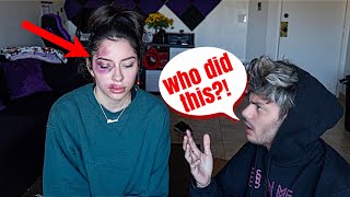 I Got Beat Up Prank On My BESTFRIEND cute reaction [upl. by Harriott]