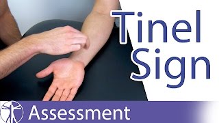 Tinel Sign Wrist  Carpal Tunnel Syndrome Diagnosis [upl. by Armbruster]