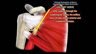 NERVE INJURY IN THE UPPER EXTREMITY Everything You Need To Know  Dr Nabil Ebraheim [upl. by Berl]